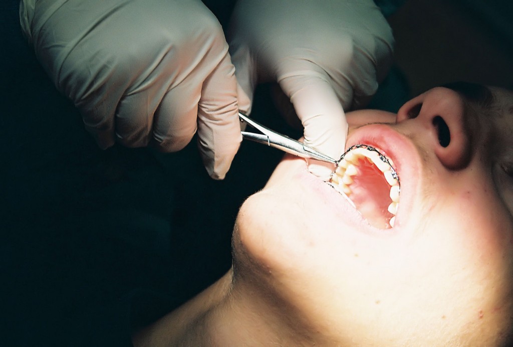 dolor dientes cancer