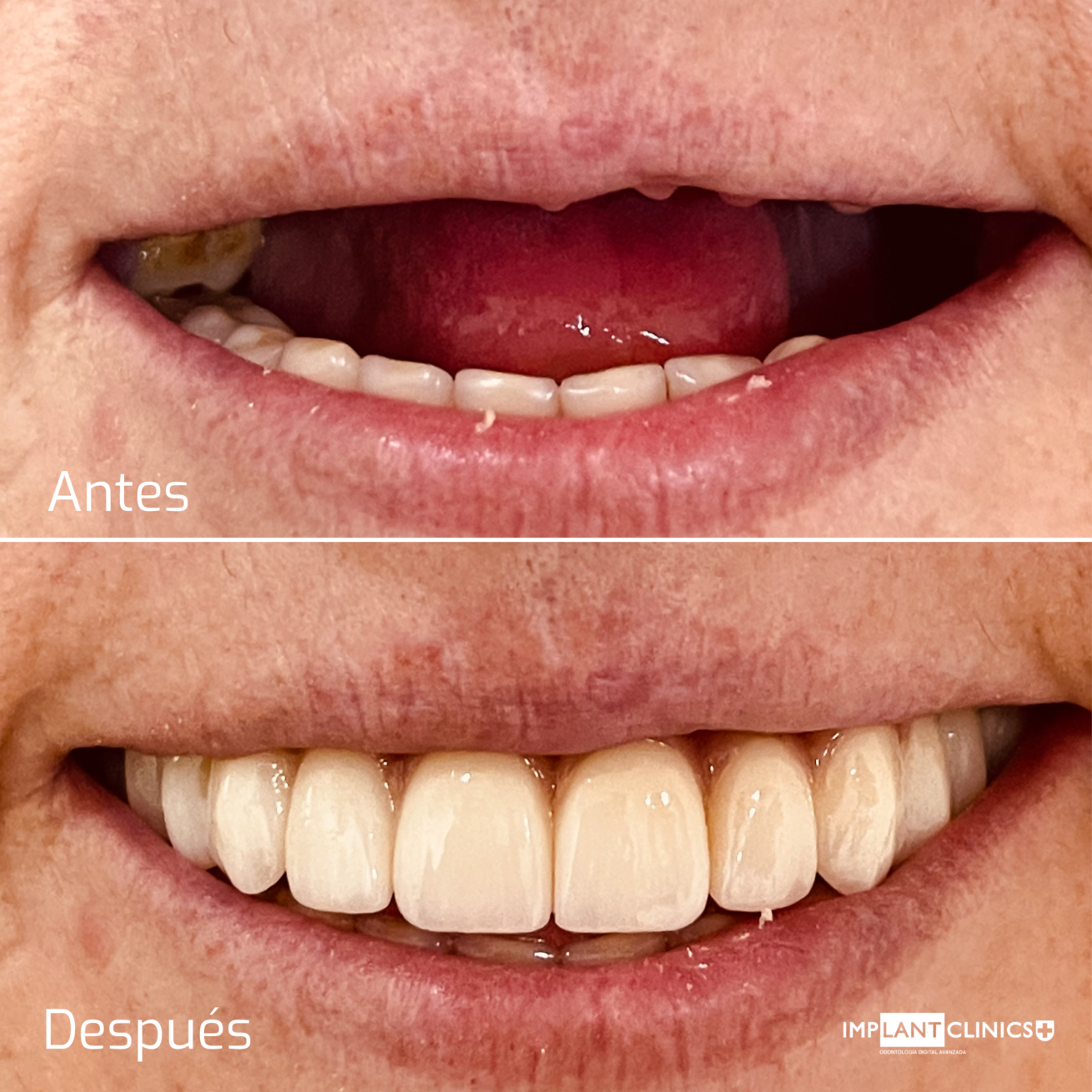 Blog de odontología, Blog clínica dental